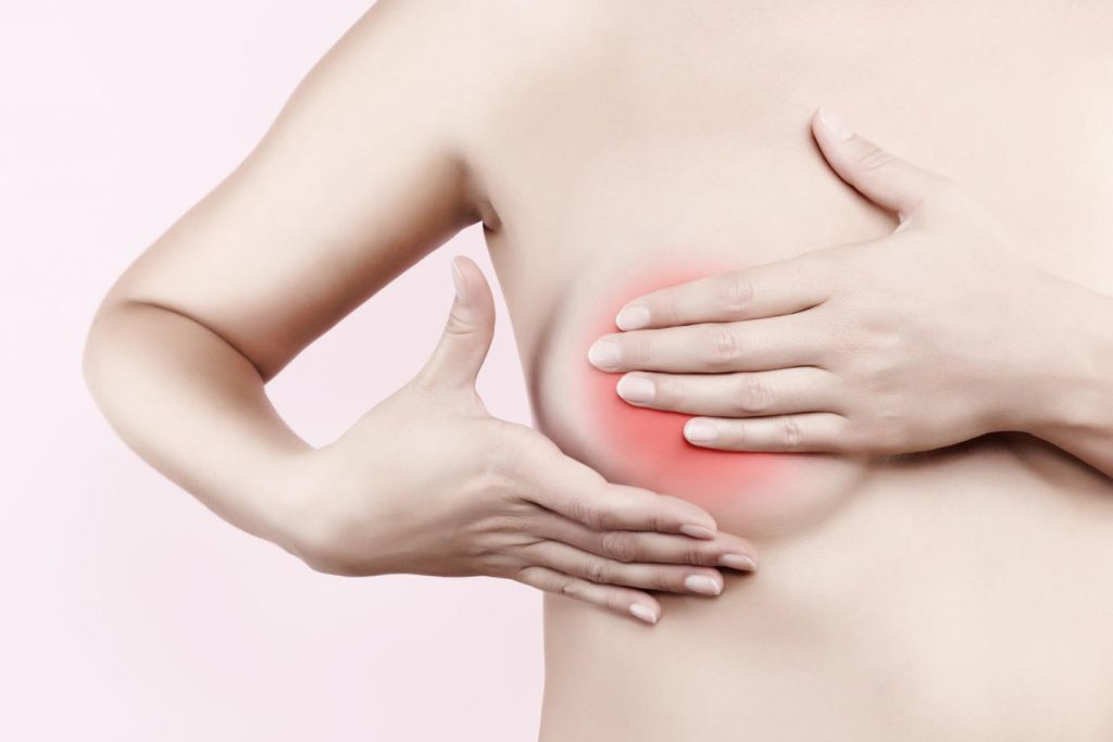 Breast cancer