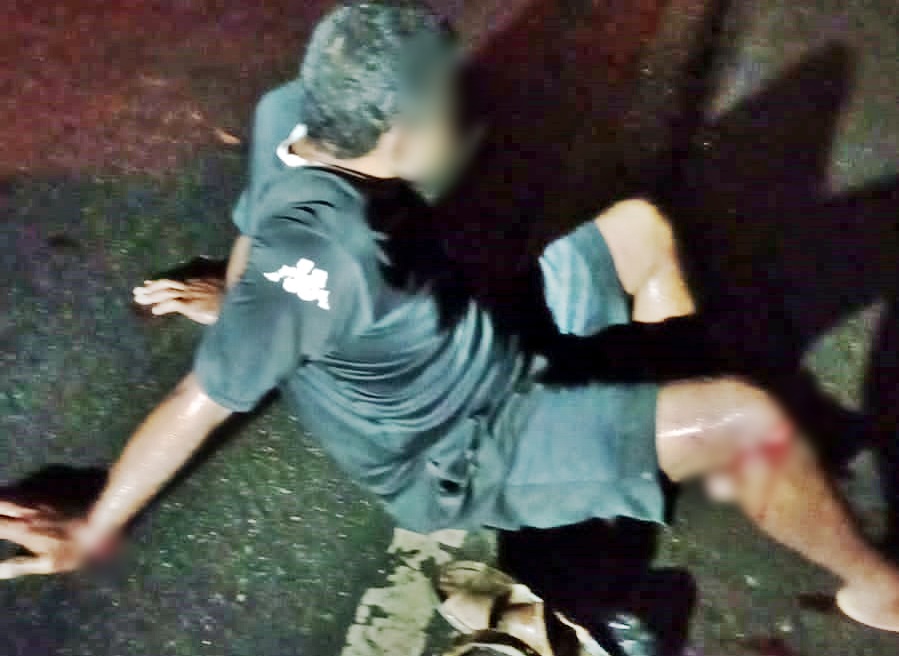 SAMU socorre vítima de atropelamento na AL-420