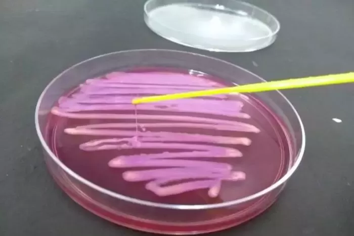 Nova geração de superbactérias aumentam em hospitais brasileiros