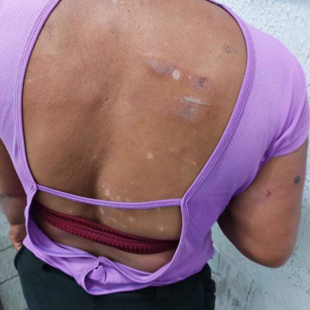 PC prende homem em flagrante por lesão corporal contra companheira