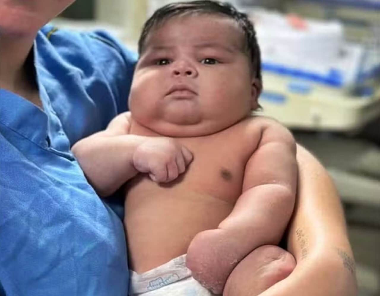 Bebê com mais de 6 quilos e 55 centímetros nasceu por parto normal em ES