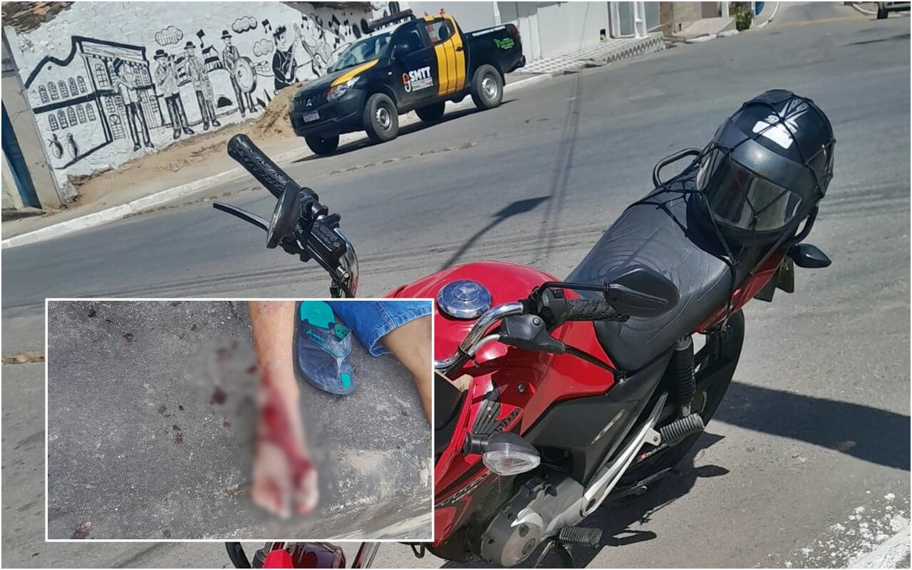 Motociclista com sinais de embriaguez tem o pé mutilado após acidente em São Miguel dos Campos