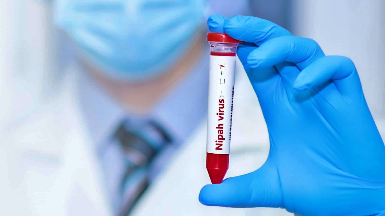 Novo surto do vírus Nipah na Ásia acende alerta em aeroportos
