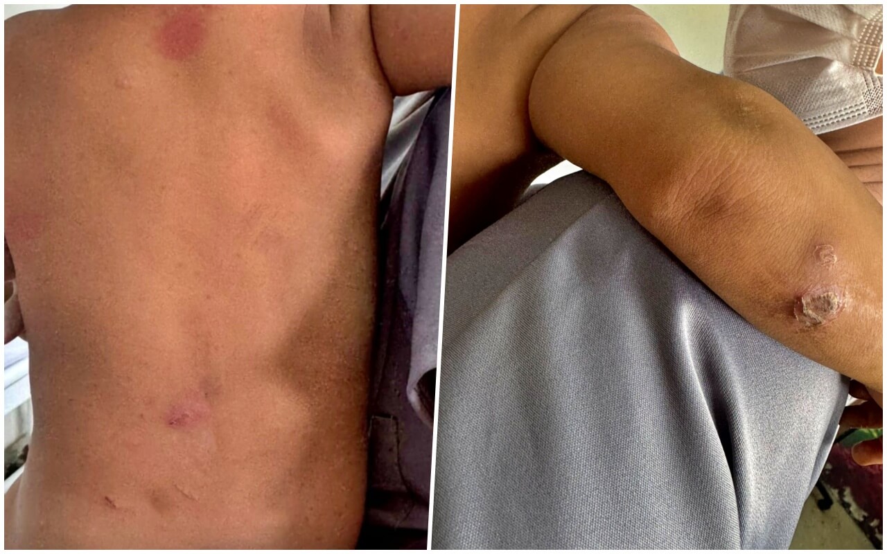 Polícia Civil prende mulher em flagrante por maus-tratos e abandono de incapaz